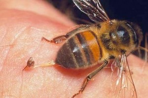 Як лікувати укуси ос і бджіл?
