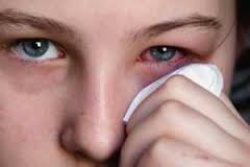 Які бувають алергічні захворювання?